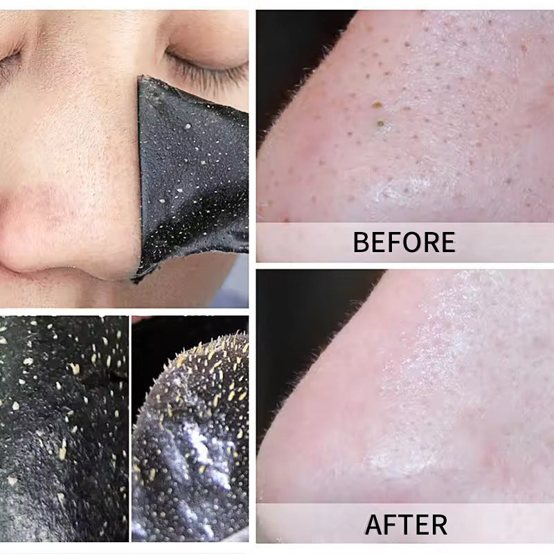 Nasal Sticker Shrink And Clean Pores Blackhead Acne Skin Care Products - clickit2shipit